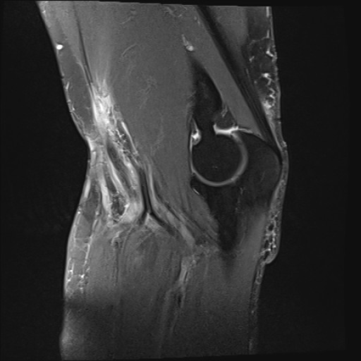 Click on the Serie image to view the images of Wieszt, Gnter